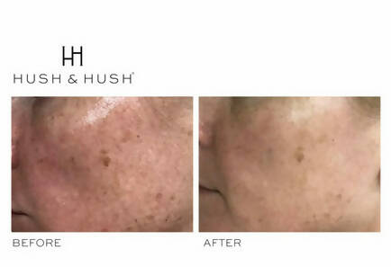SkinCapsule BRIGHTEN+