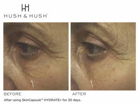 SkinCapsule HYDRATE+