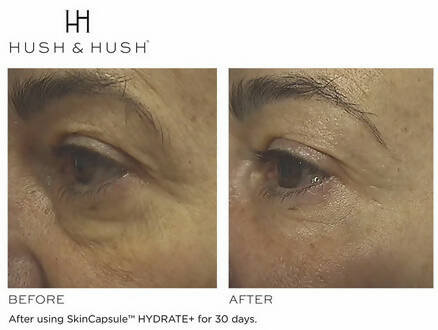 SkinCapsule HYDRATE+