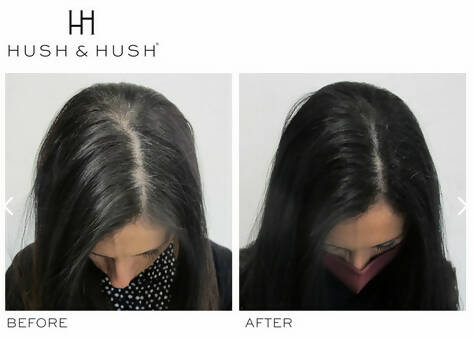 DeeplyRooted Hair Serum