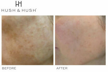 SkinCapsule BRIGHTEN+