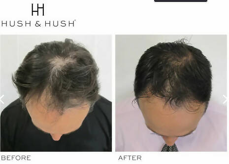 DeeplyRooted Hair Serum
